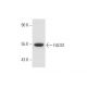 FADS1 Antibody (7-RY13) - Western Blotting - Image 57643