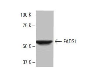 FADS1 Antibody (7-RY13) - Western Blotting - Image 64936 