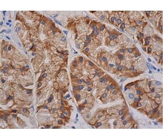 immunohistochemistry image from recommended FAK (D-1) monoclonal antibody replacement. Image 352997