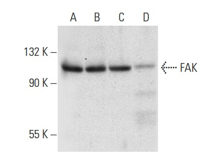 S.K.K.ページ♡ FAK Antibody (B-8) | SCBT - Santa Cruz S.K.K.ページ♡ FAK Antibody (B-8) | SCBT - Santa Cruz