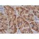 immunohistochemistry image from recommended FAK (D-1) monoclonal antibody replacement. Image 352997
