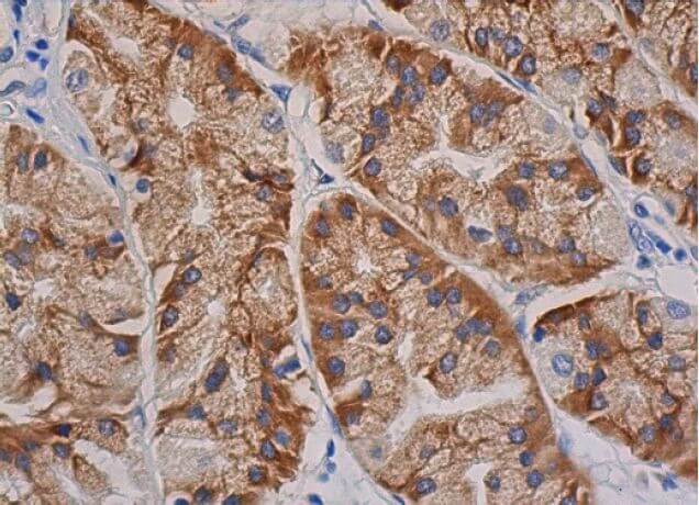 fak-antibody-d-1-