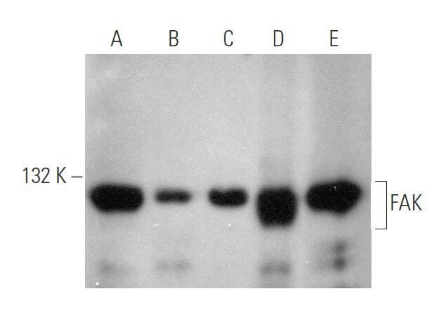 代引き人気 FAK Antibody (D-1) | SCBT - Santa Cruz Biotechnology 犬服・アクセサリー