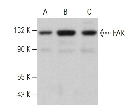 FAK抗体(D-1) | SCBT - Santa Cruz Biotechnology