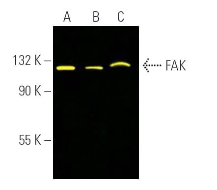 FAK Antibody (D-1) | SCBT - Santa Cruz Biotechnology