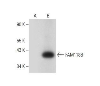 FAM118B Antibody (C-11) - Western Blotting - Image 314493Each CRISPR/Cas9 Knockout (KO) Plasmid product consists of a pool of 3 plasmids designed to ensure identification and cleavage of a specific gene for maximum knockout efficiency. Each plasmid encodes a unique 20 nt sequence derived from the GeCKO (v2) library. 