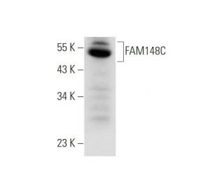 FAM148C Antibody (F-10) - Western Blotting - Image 344110Each CRISPR/Cas9 Knockout (KO) Plasmid product consists of a pool of 3 plasmids designed to ensure identification and cleavage of a specific gene for maximum knockout efficiency. Each plasmid encodes a unique 20 nt sequence derived from the GeCKO (v2) library. 