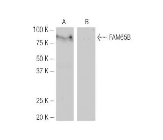 FAM65B Antibody (3J7) - Western Blotting - Image 64878