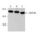 FAM70B Antibody (E-4) - Western Blotting - Image 375590 