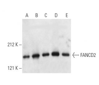 western blotting image from recommended FANCD2 (FI17) monoclonal antibody replacement. Image 3678