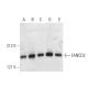 western blotting image from recommended FANCD2 (FI17) monoclonal antibody replacement. Image 3678