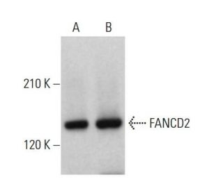 FANCD2 Antibody (FI17) - Western Blotting - Image 379209 