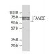 FANCG Antibody (75-A) - Western Blotting - Image 34114 