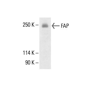 FAP Antibody (73.3) - Western Blotting - Image 411225