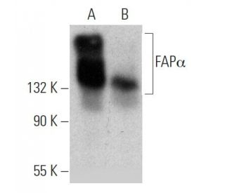 western blotting image from recommended FAP&alpha; (SS-13) monoclonal antibody replacement. Image 368194