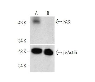 FAS HDR Plasmid (h): sc-400481-HDR. Western blot analysis of FAS... 