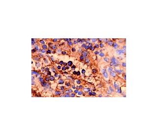 FAS-L Antibody (Kay-10) - Immunohistochemistry - Image 74 