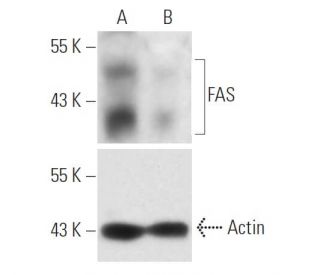 FAS siRNA (h): sc-29311. Western blot analysis of FAS expression in non-transfected control (A) and FAS siRNA transfected 