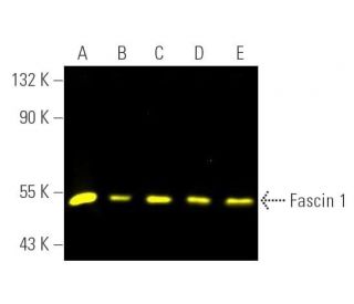 Fascin 1 Antibody (D-10) - Western Blotting - Image 391032