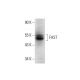 FAST Antibody (B-9) - Western Blotting - Image 137816 