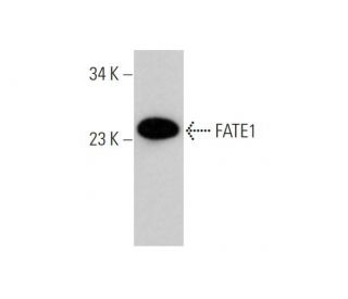 FATE1 Antibody (B5-9) - Western Blotting - Image 346970The Double Nickase Plasmid features a U6 promoter for sgRNA expression, a 20 nt targeting sequence, and a gRNA scaffold to guide Cas9n. It includes a CBh promoter for Cas9n (D10A) and puromycin resistance, GFP for transfection verification, and nuclear localization signals (NLS). The 2A peptide allows co-expression of Cas9n and Puro from a single promoter, enabling precise genome editing with reduced off-target effects.