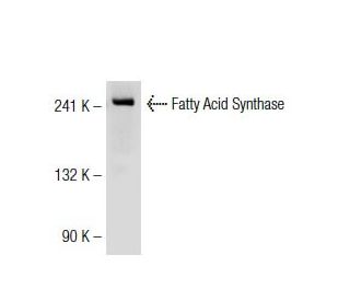 Fatty Acid Synthase Antibody (G-11) - Western Blotting - Image 32910