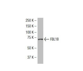 FBL18 Antibody (LL-3) - Western Blotting - Image 34112 