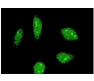FBP2 Antibody (4C10) - Immunofluorescence - Image 351760 