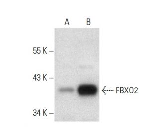 FBXO2 Antibody (E-9) - Western Blotting - Image 301364 