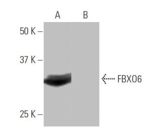 FBXO6 Antibody (7B11) - Western Blotting - Image 64938