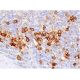 Fc ε RIα Antibody (1F2A9) - Immunohistochemistry - Image 384186