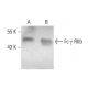 Fc γ RIIb Antibody (RR05) - Western Blotting - Image 384466 