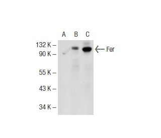Fer Antibody (2358C3a) - Western Blotting - Image 72740 