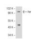 Fer Antibody (5D2C4) - Western Blotting - Image 72739