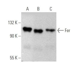 Fer Antibody (5D2C4) - Western Blotting - Image 370749 