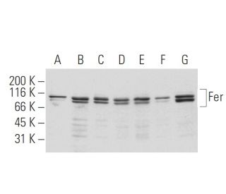 Fer Antibody (6B9) - Western Blotting - Image 62906