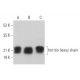 western blotting image from recommended ferritin heavy chain (B-12) monoclonal antibody replacement. Image 361706
