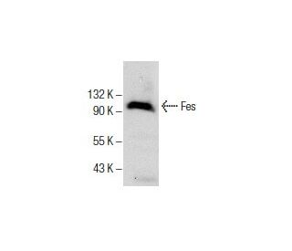 western blotting image from recommended Fes (D-9) monoclonal antibody replacement. Image 285967