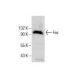 western blotting image from recommended Fes (D-9) monoclonal antibody replacement. Image 285967