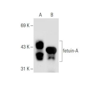 fetuin-A Antibody (H-11) - Western Blotting - Image 57646