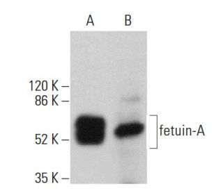 fetuin-A Antibody (H-4) - Western Blotting - Image 359649 