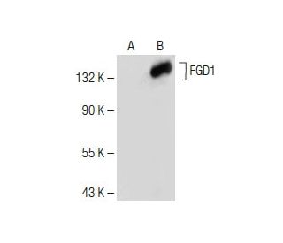 FGD1 Antibody (E-10) - Western Blotting - Image 150228