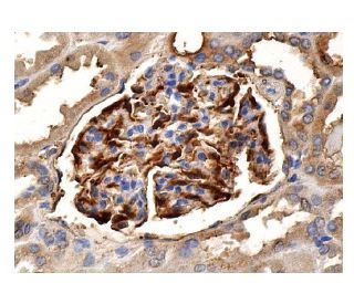 immunohistochemistry image from recommended FGF-1 (B-3) monoclonal antibody replacement. Image 156890