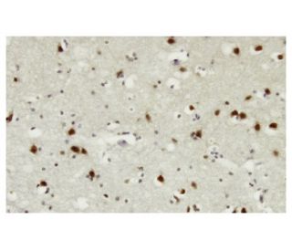 FGF-12 Antibody (ZA-12) - Immunohistochemistry - Image 35943