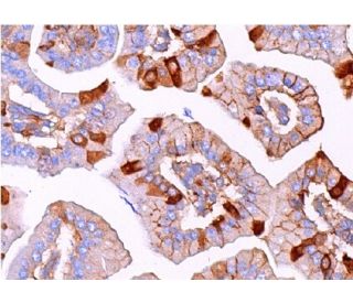 immunohistochemistry image from recommended FGF-15 (D-9) monoclonal antibody replacement. Image 375208