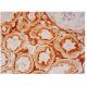 FGF-19 Antibody (H-12) - Immunohistochemistry - Image 302380 