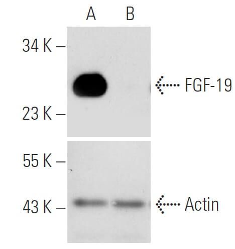 fgf 19 sirna h shrna and lentiviral particle gene silencers