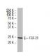 FGF-21 Antibody (Y-16) - Western Blotting - Image 33597 