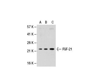 FGF-21 Antibody (Y-16) - Western Blotting - Image 30058