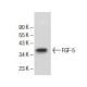 This polyclonal antibody has been discontinued. See our recommended <a href="fgf-5-antibody-f-11">FGF-5 (F-11)</a> monoclonal antibody (sample data shown). western blotting image from recommended FGF-5 (F-11) monoclonal antibody replacement. Image 154928